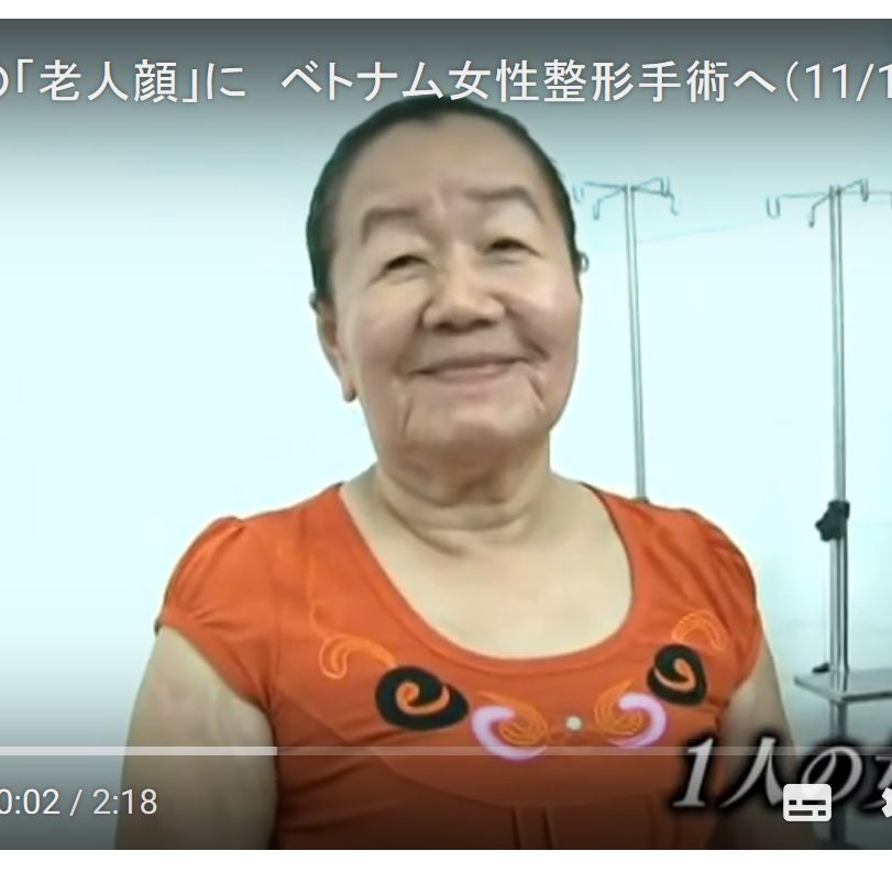 原因不明の奇病 ベトナムの美人女性 26歳 が８０歳代の老人顔に ゆるゆる倶楽部 まとめde Goo